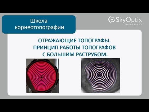 Видео: Школа корнеотопографии: Отражающие топографы. Принцип работы топографов с большим раструбом.