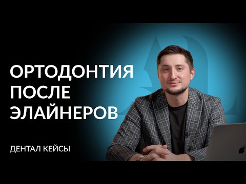 Видео: Тотальная реабилитация после ортодонтического лечения на элайнерах | ДенталКейсы | Артур Лукьяненко