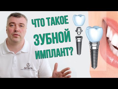 Видео: Нужно ли устанавливать зубной имплант? (Школа здоровых зубов)