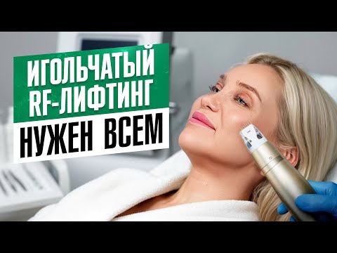Видео: После 30 он нужен всем! Эффект от игольчатого RF-лифтинга шокирует