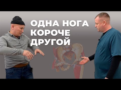 Видео: Одна нога короче другой | Костоправ Левых Владимир