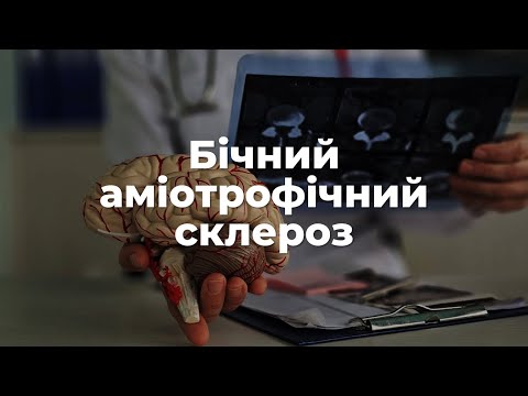 Видео: Бічний аміотрофічний склероз