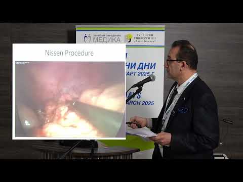 Видео: 43.Запазването на късите стомашни съдове по време на лапароскопска фундопликация може да бъде...