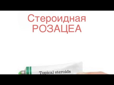 Видео: СТЕРОИДНАЯ РОЗАЦЕА: причины и проявления