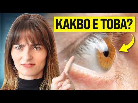 Видео: Кератоконус!? Какво е това?