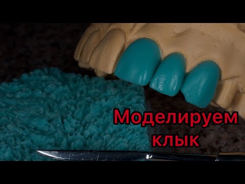 Видео: Моделировка зубов. Как моделировать клык. Серия видео моделировки зубов верхней челюсти.