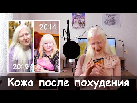 Видео: Что с моей КОЖЕЙ ПОСЛЕ ПОХУДЕНИЯ? Растяжки останутся. СМИРИТЕСЬ!