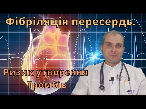 Видео: Аритмія. Ризик утворення тромбів після ковіду. Фібриляція передсердь