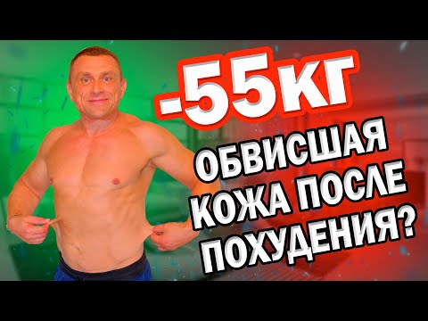 Видео: 🔥 Как Улучшить Тургор Кожи. Я Сбросил 55кг И У Меня Не Обвисла Кожа При Похудении.