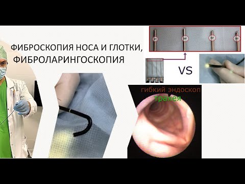 Видео: Гибкая эндоскопия VS жесткая эндоскопия ЛОР-органов: фиброларингоскопия, фиброриноскопия