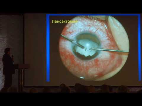 Видео: Травма глаза. Абдулаев А.В., Юбилей Клиники Офтальма Ставрополь.