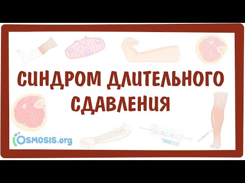 Видео: Синдром длительного сдавления (Краш-синдром)