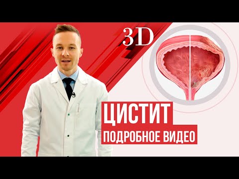 Видео: Цистит, лечение у женщин.  Почему не стоит лечить цистит в домашних условиях?