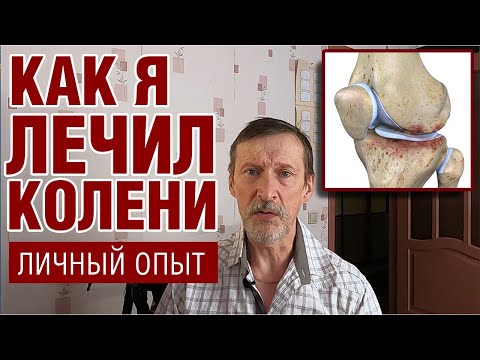 Видео: Как я лечил колени. Только личный опыт
