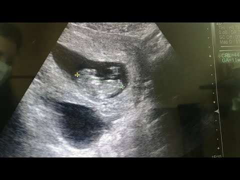 Видео: ИСТОРИЯТА НА МОЕТО РАЖДАНЕ