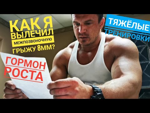 Видео: Лечение м/п грыжи гормоном роста и большими нагрузками.