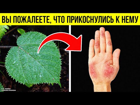 Видео: Коварное растение, ожог которого не заживает годами