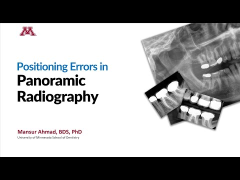 Видео: Ошибки позиционирования при панорамной рентгенографии