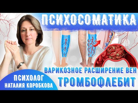 Видео: Психосоматика варикоза и тромбофлебита. Психосоматические причины появления и как лечить.