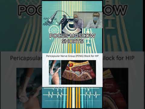Видео: Pericapsular Nerve Group PENG СЕРИЯ РЕГИОНАРНАЯ АНЕСТЕЗИЯ ЭКСПЕРТНОГО УРОВНЯ by POCUS MOSCOW