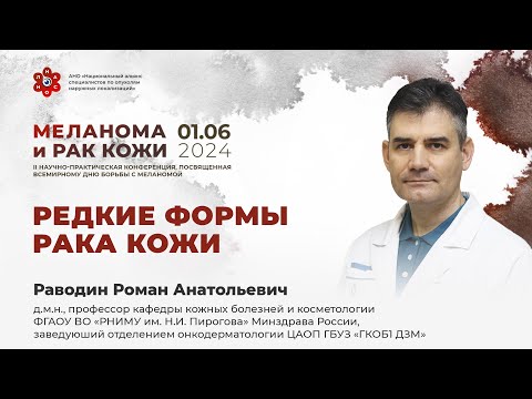 Видео: Редкие формы рака кожи. Раводин Р. А.