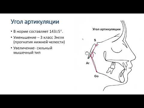 Видео: Анализ ТРГ по Ярабах   Бьерк