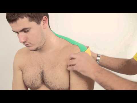 Видео: Кинезио тейпирование при травмах плеча