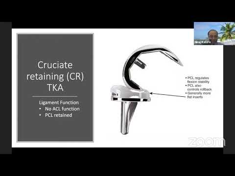 Видео: Конструкция имплантата при тотальном эндопротезировании коленного сустава