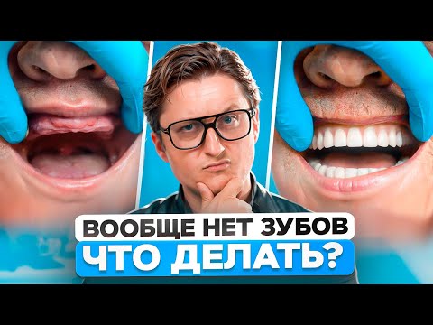 Видео: Если у вас не осталось зубов, ДЕЛАЙТЕ ЭТО! Можно ли поставить импланты на все зубы?