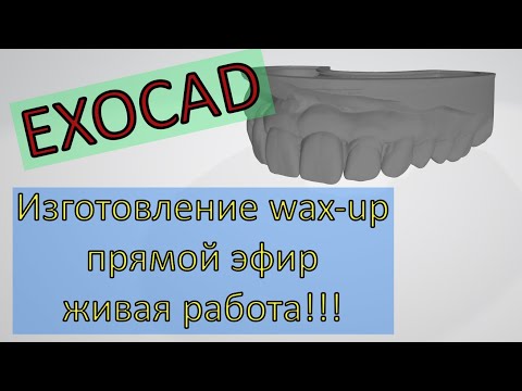 Видео: Изготовление WAX-UP в прямом эфире! Живая работа!!! Планирование протезирования!