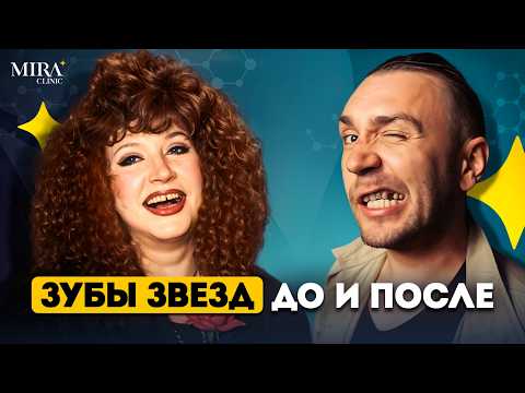 Видео: ЗУБЫ ЗВЁЗД: кто сделал виниры удачно, а кто — ЗРЯ? Mira Clinic
