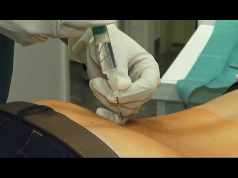 Видео: Блокада – эффективный метод лечения боли - в программе "600 секунд о здоровье и красоте"