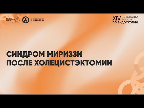 Видео: Синдром Мириззи после холецистэктомии