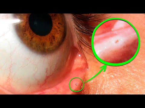 Видео: 17 Вещей, о Которых Вы не Знали 5 Минут Назад