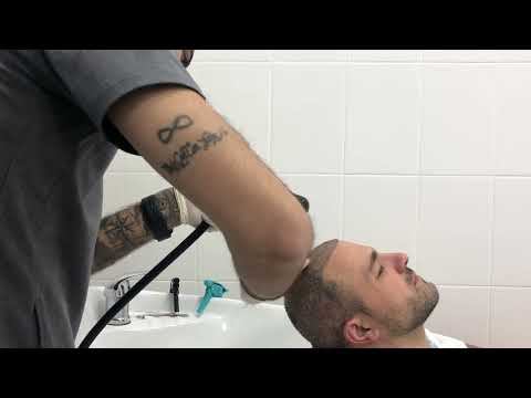 Видео: Избавляемся от корочек через 10 моек после пересадки волос . #Халилкоч