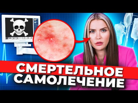 Видео: ОПАСНЫЕ ПРЫЩИ ⚠️ Смертельные капельницы красоты