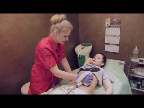 Видео: Аппарат по коррекции фигуры VELA SHAPE III