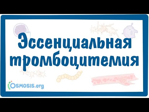 Видео: Эссенциальная тромбоцитемия — причины, симптомы, патогенез, диагностика, лечение