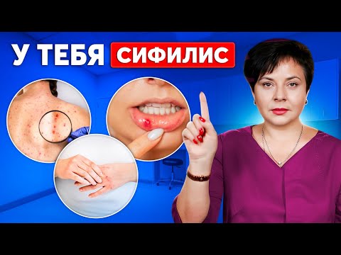 Видео: 5 ранних СИМПТОМОВ СИФИЛИСА и страшные последствия бездействия