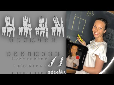 Видео: 6 ключей окклюзии.Применение в практике. Andrews six keys of occlusion (Russian +English subtitles)