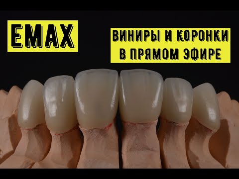 Видео: "Изготовление коронк и винир emax, живая работа в прямом эфире, все этапы нанесения керамики emax."