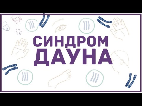 Видео: Синдром Дауна - причины, симптомы, диагностика - кратко