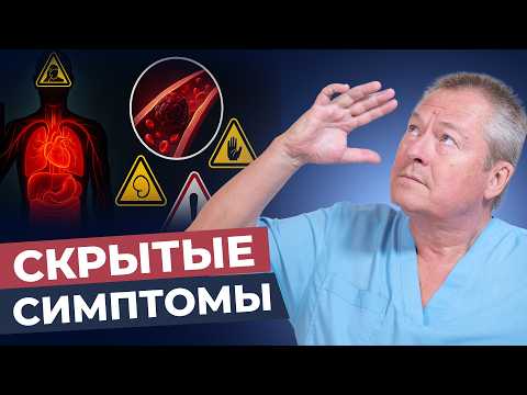 Видео: Врачи МОЛЧАТ об этом! Распознайте тромбы ДО ИНСУЛЬТА за 5 минут дома