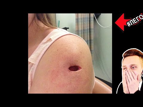 Видео: Попробуй не скажи ОЙ! / РЕАКЦИЯ на САМОЕ НЕ ПРИЯТНОЕ ВИДЕО в МИРЕ