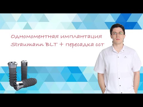 Видео: Одномоментная установка имплантанта Straumann BLT + пересадка десны