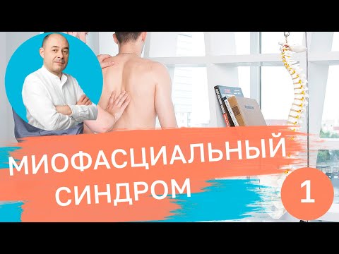 Видео: Миофасциальный синдром - самая частая причина боли в спине