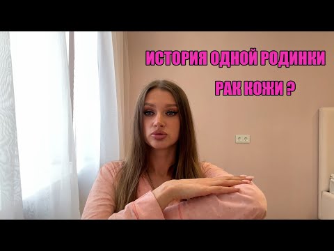 Видео: История одной родинки. Рак кожи? Моя история