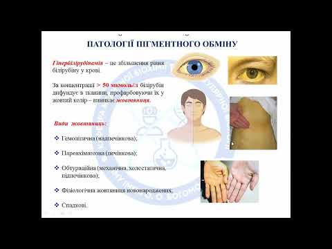 Видео: Метаболізм жовчних пігментів. Жовтяниці.