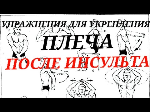 Видео: УПРАЖНЕНИЯ ДЛЯ УКРЕПЛЕНИЯ ПЛЕЧА ПОСЛЕ ИНСУЛЬТА  , ЛИЧНЫЙ ОПЫТ РЕАБИЛИТАЦИИ