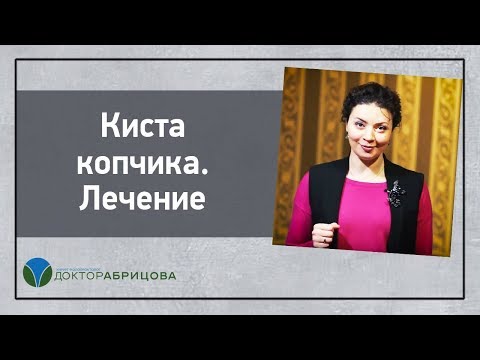 Видео: Киста копчика. Лечение эпителиального копчикового хода